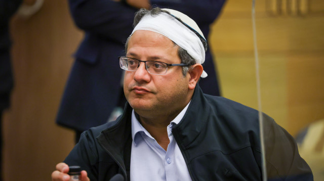 איתמר בן גביר, לאחר שנפצע במהומות בשכונת שייח' ג'ראח (צילום: נועם מושקוביץ, דוברות הכנסת)