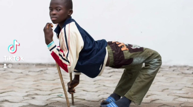 אולריך, נאלץ להיעזר במקלות שיסייעו לו לנוע ממקום למקום (צילום: צילום מסך טיקטוק)