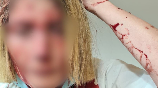 הרופאה שהותקפה בבאר יעקב  (צילום: ללא קרדיט)