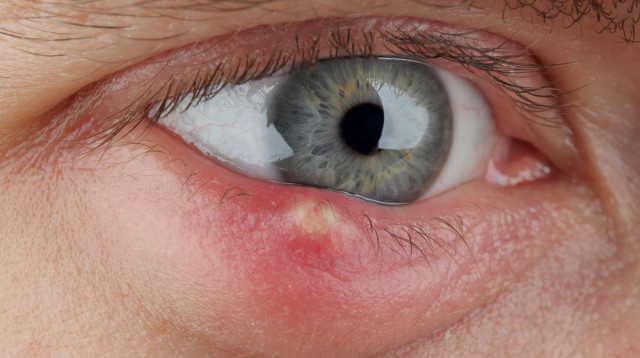 כל מה שרציתם לדעת על שעורה (צילום: Shutterstock)