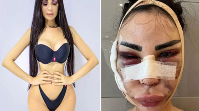 ג'ניפר פמפלונה, שילמה הון כדי להיראות כמו קים קרדשיאן, ועכשיו משלמת לא מעט כדי לחזור לפניה הטבעיות (צילום: מתוך פייסבוק)