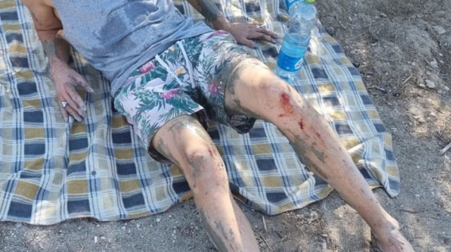 ליאור ישראלי, נפל לתוך בולען שכיסה חצי מגופו (צילום: מתוך אינסטגרם)