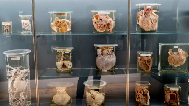 איברים משומרים בני 200 שנה מוצגים במוזיאון בווינה (צילום: Getty images)