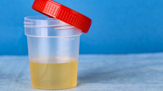 מה ריח הפיפי אומר עליכם? (צילום: אינג'אימג')