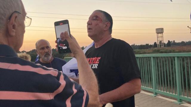 המפגינים שהותקפו  (צילום:  חוזרים לגשרים ולצמתים)