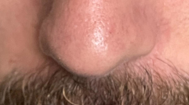 אף, אילוסטרציה (צילום: פרטי)