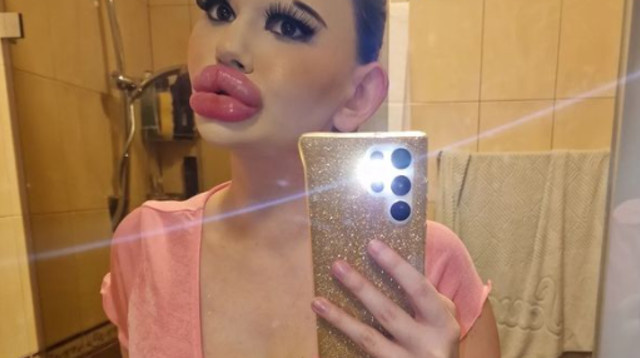 הרופאים הזהירו אותה, אך היא בשלה (צילום: מתוך אינסטגרם)