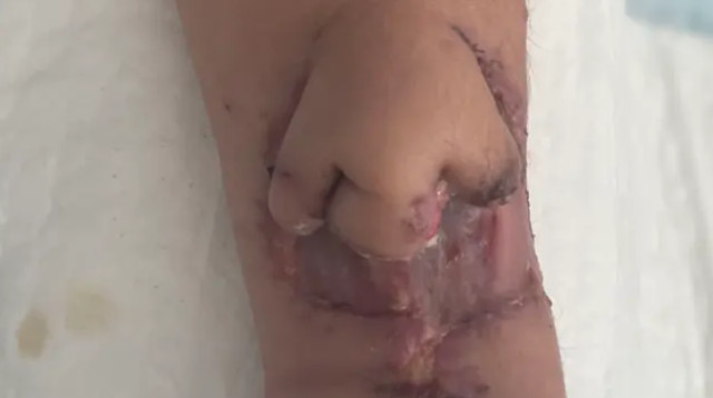 גידלה אף על הזרוע - זו הסיבה (צילום: פייסבוק)