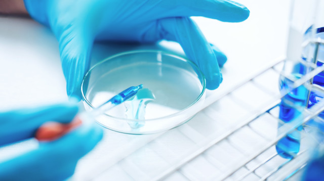 המחקר, שהחל בשנה שעברה, נועד לקבוע כיצד וירוסים מתפתחים (צילום: אינג'אימג')