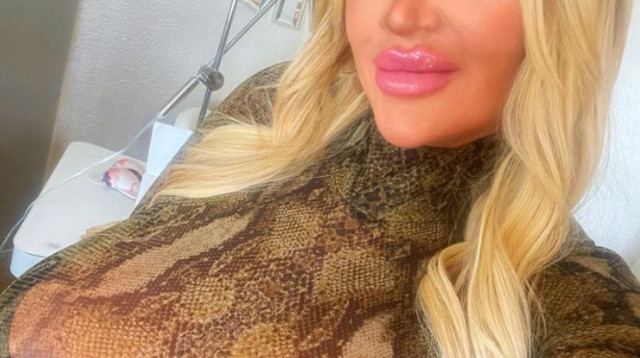 קול, מכורה לניתוחים פלסטיים (צילום: מתוך אינסטגרם)