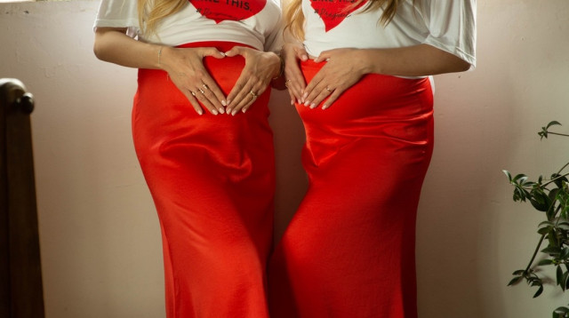 נוי והדר (צילום: נוי ערקובי)