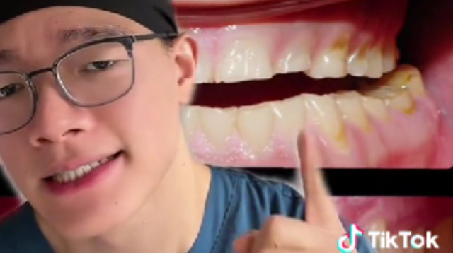 שלושת ההרגלים הללו פוגעים בבריאות השיניים שלכם (צילום: מתוך טיקטוק)