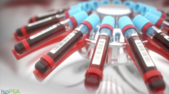 בדיקת דם (צילום:  IsoPSA)