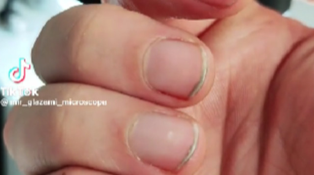 זה מה שמסתתר מתחת לציפורניים של כולנו (צילום: מתוך טיקטוק)