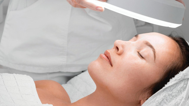 טיפול בפיגמנטציה בפנים, אילוסטרציה (צילום: אינגאימג')
