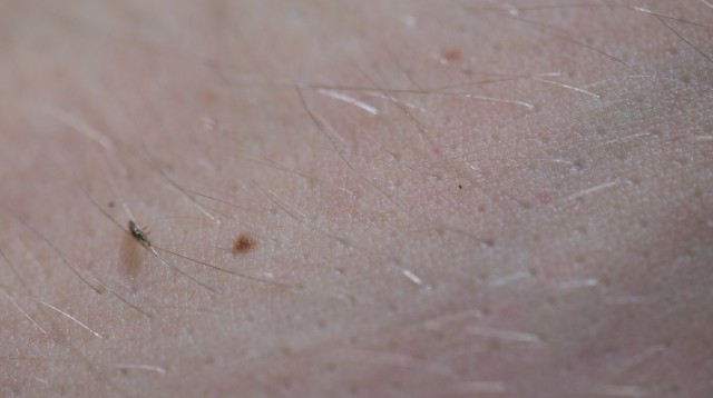 טפיל, אילוסטרציה (צילום: אינגאימג')