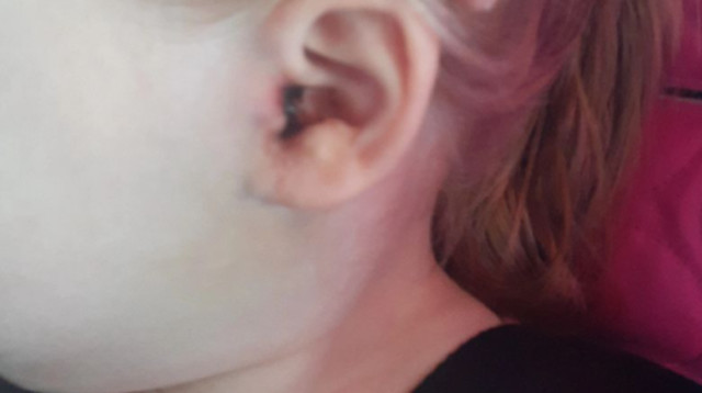 הלכלוך באוזן התגלה כפרט מזעזע (צילום: מתוך טיקטוק)