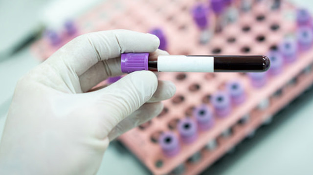 בדיקת HIV. ללא תשלום לאחר מין לא מוגן  (צילום: Jasmin Merdan gettimages)