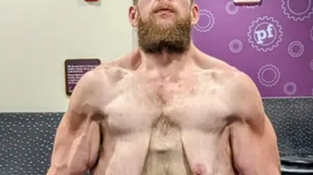 קול פרוצ'סקה, ירד 165 ק"ג וכעת צריך להיפטר מהעור העודף (צילום: רשתות חברתיות)