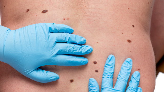 נקודות החן שאסור להתעלם מהן (צילום: אינג'אימג')