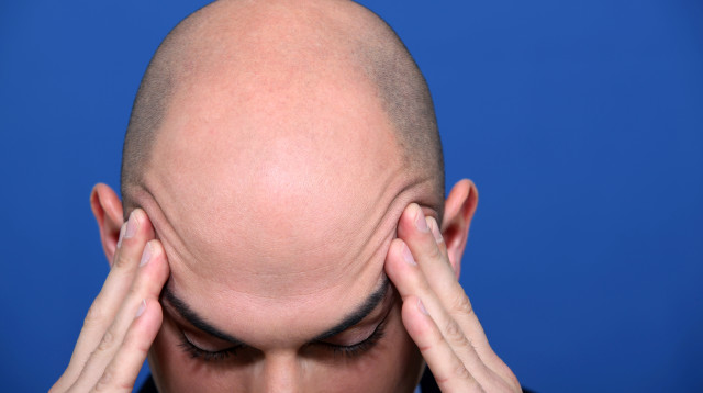 נמצאה התרופה להתקרחות? (צילום: אינג'אימג')