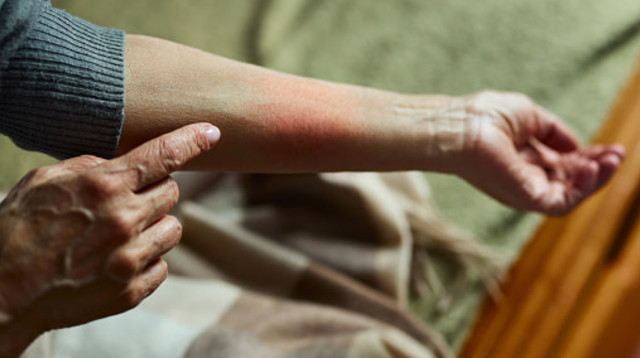 המון אנשים חושבים שלמחלה הזו אין פתרון. הם טועים (צילום: skynesher gettyimages)