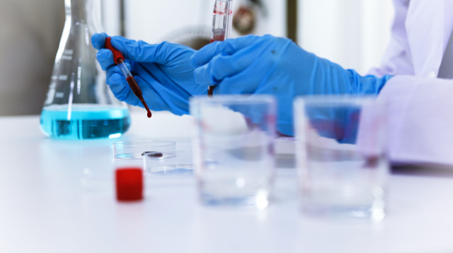 ביצעה בדיקת DNA וגילתה פרט על משפחתה (צילום: אינג'אימג')