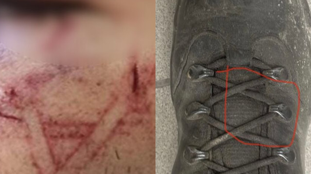 הנעל של השוטר שעל פי המשטרה גרמה לחבלה בפני העצור בשועפאט (צילום: דוברות המשטרה)