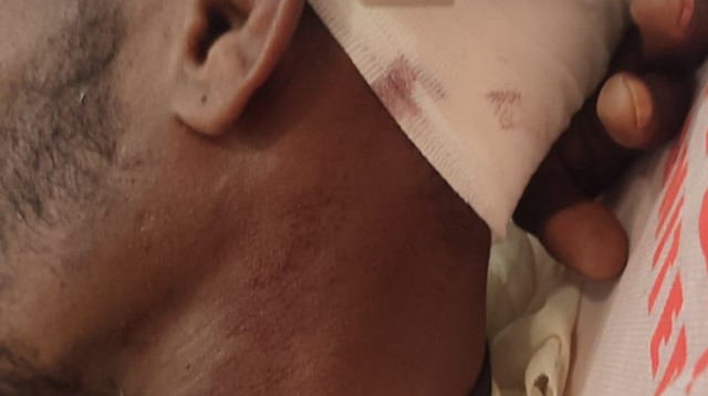 השוטר שנפגע בראשו ובכתפו כתוצאה מיידוי האבנים (צילום: דוברות המשטרה)