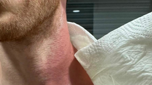 זוג בתל אביב הותקף בגז פלפל בשל נטייתו המינית (צילום: באדיבות המצולם)