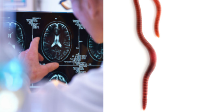 תולעת טפילית אותרה במוחה של אישה בת 64 (צילום: אינג'אימג')