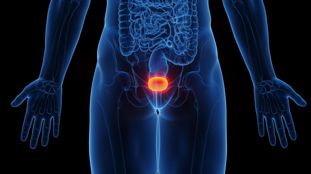תמונת אילוסטרציה סרטן הערמונית (צילום: האגודה למלחמה בסרטן)