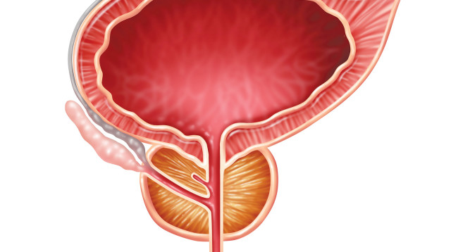 ערמונית  (צילום: אינג אימאג)