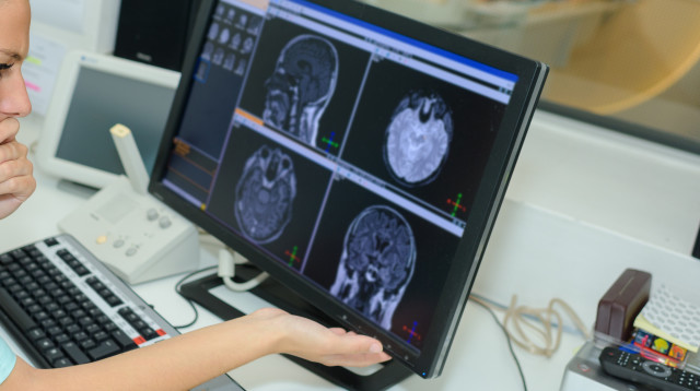 בדיקת CT, אילוסטרציה (צילום: אינג'אימג')