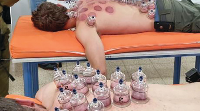 טיפול בכוסות רוח לחיילים (צילום: יח"צ)