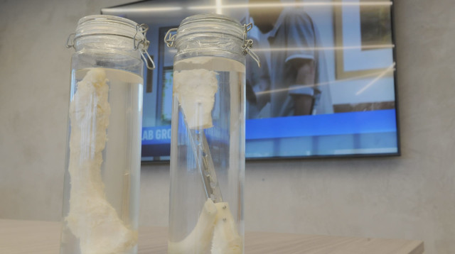 הטיפול בבי"ח ברזילי (צילום: יח"צ)