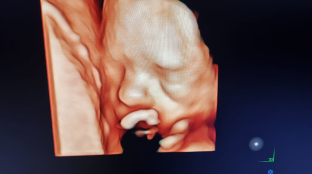 אולטרסאונד בהפתעה לחיילים (צילום: ד"ר יזהר ארז, תמונות NinePlus.Life)