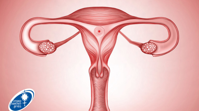 סרטן צוואר הרחם  (צילום: האגודה למלחמה בסרטן)