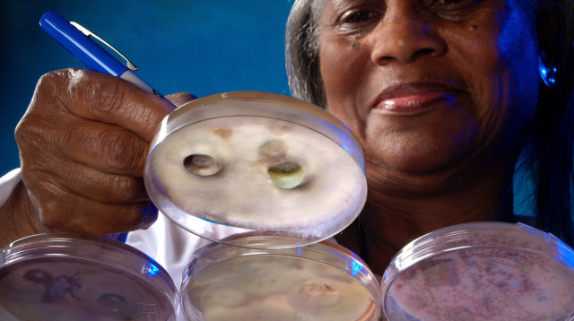 פטריית פוסריום (צילום: James Gathany/CDC )