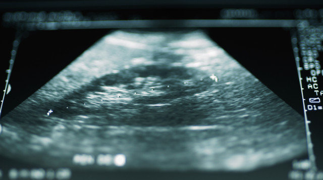 הריון, אילוסטרציה (צילום: אינג'אימג')