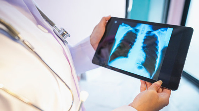  על רקע השכיחות הגבוהה של המחלה, מהווה המחלה את אחד התחומים הנחקרים בעולם הביולוגיה והרפואה (צילום: Prapass Pulsub gettyimages)