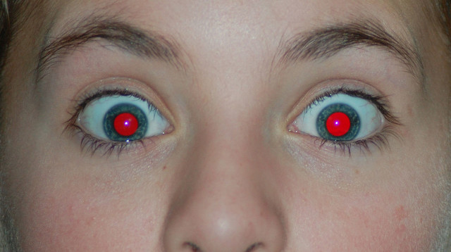 עיניים אדומות בצילום בפלאש (צילום: ויקיפדיה)