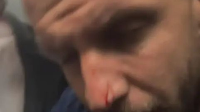 לוקאס סאשה נפצע אחרי שהאוטובוס של קבוצת פורטלזה הותקף (צילום: צילום מסך, אינסטגרם)