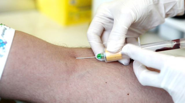 הטיפול בסרטן המעי הגס (צילום: אינגאימג')