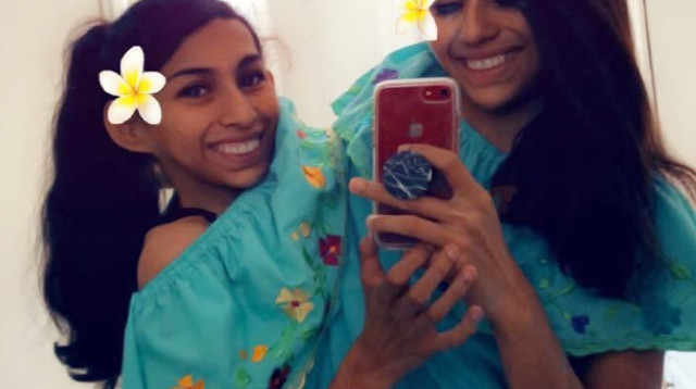 קרמן ולופיטה, התאומות הסיאמיות (צילום: מתוך אינסטגרם)