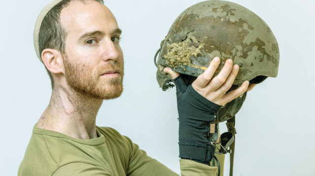 יותם אלון והקסדה שהצילה אותו (צילום: יוסי אלוני)