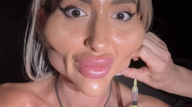 פוקרשצ'וק, התמונה שזעזעה את מעריציה (צילום: מתוך אינסטגרם)