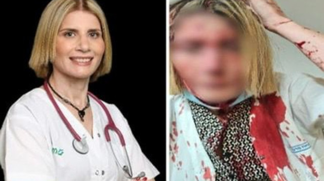 ד״ר אידית וייסבוך שהותקפה בפטיש בראשה (צילום: ללא קרדיט)