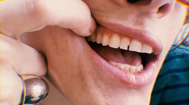 מי הזמרת ששברה שן? (צילום: צילום מסך אינסטגרם)