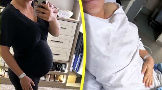 מעיין אדם לפני ואחרי הניתוח (צילום: צילום מסך מתוך האינסטגרם)